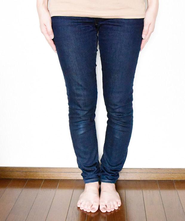 O脚･X脚のイメージ