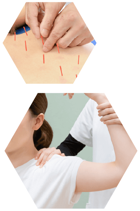 ほねラボ整骨院 我孫子駅北口院 全身骨格矯正の施術・矯正 根本改善のイメージ