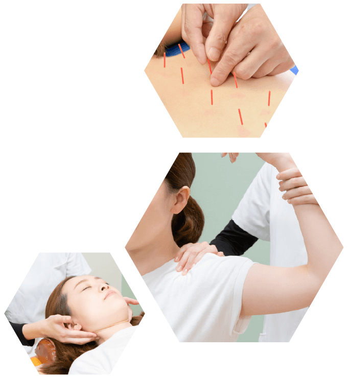 ほねラボ整骨院 我孫子駅北口院 労災保険治療の施術・矯正 根本改善のイメージ