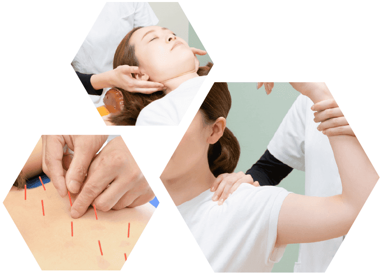 ほねラボ整骨院 我孫子市の我孫子駅北口院の施術・矯正 根本改善のイメージ